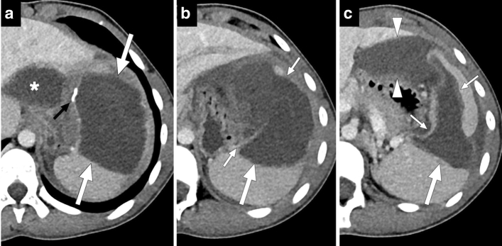 Fig. 14