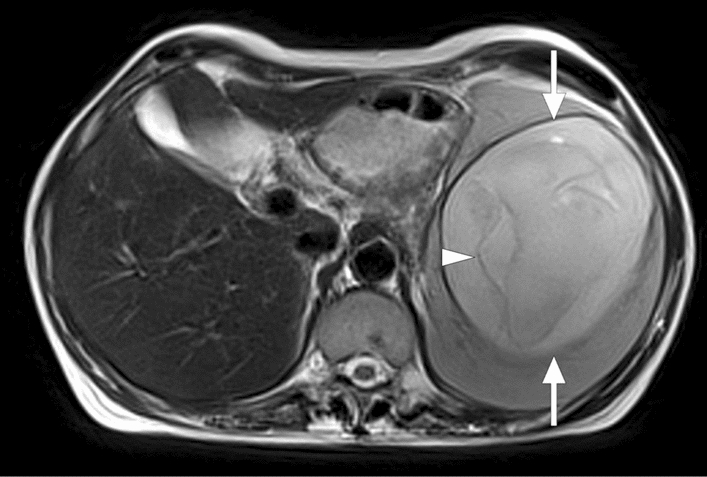 Fig. 13