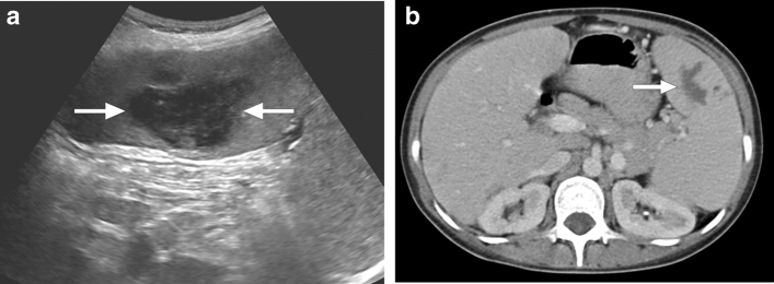 Fig. 21