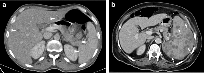 Fig. 17