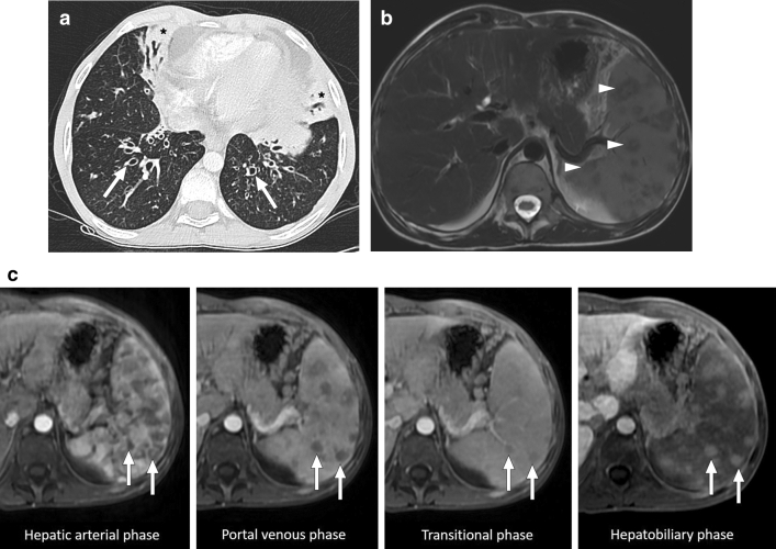 Fig. 19