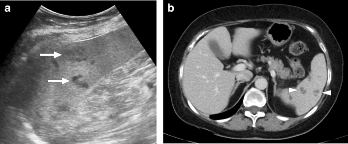 Fig. 24