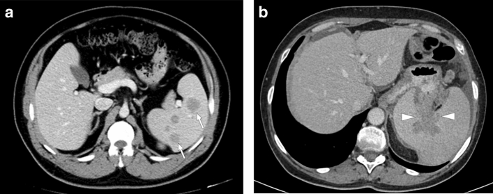 Fig. 28