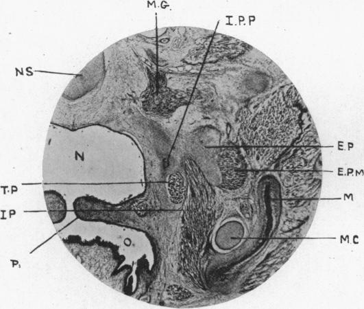 Fig. 12