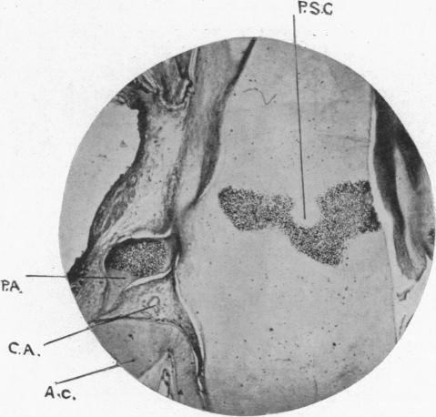 Fig. 15