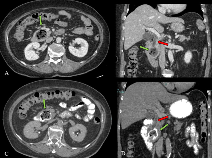 Fig 2