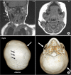 Fig. 2
