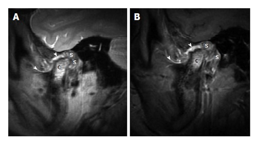 Figure 16