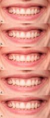 Fig. 3