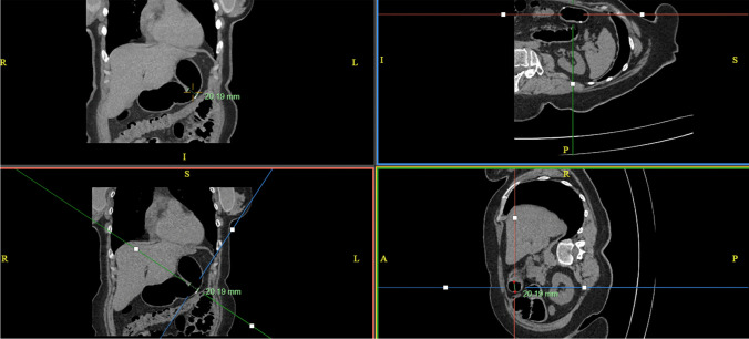 Fig. 2