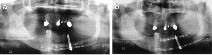 Fig. 11