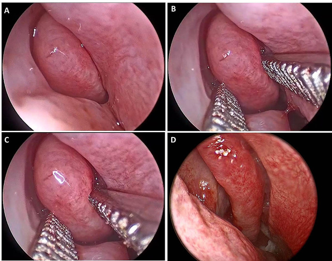 Fig. 3