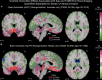 Figure 3—figure supplement 4.