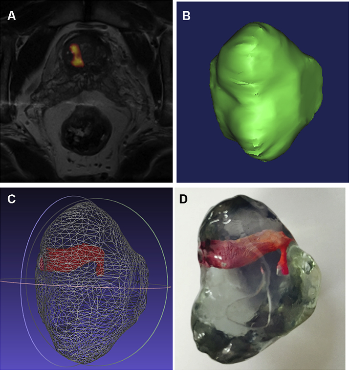 Figure 1