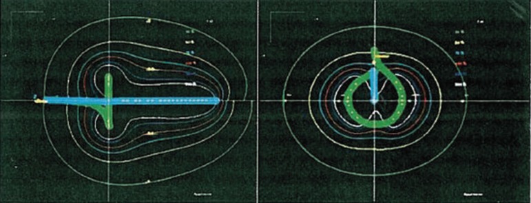 Fig. 6