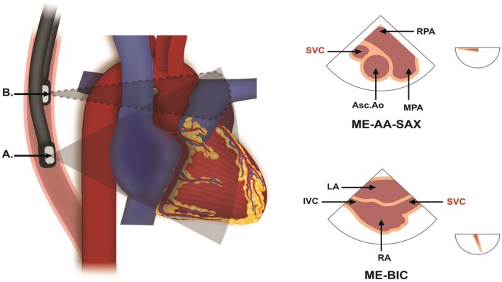 Fig. 3