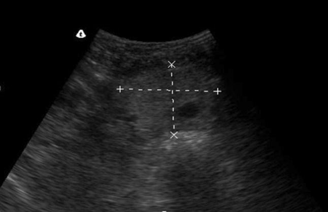 Fig. 4