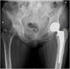 Image. 4