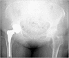 Image. 1