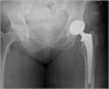 Image. 3