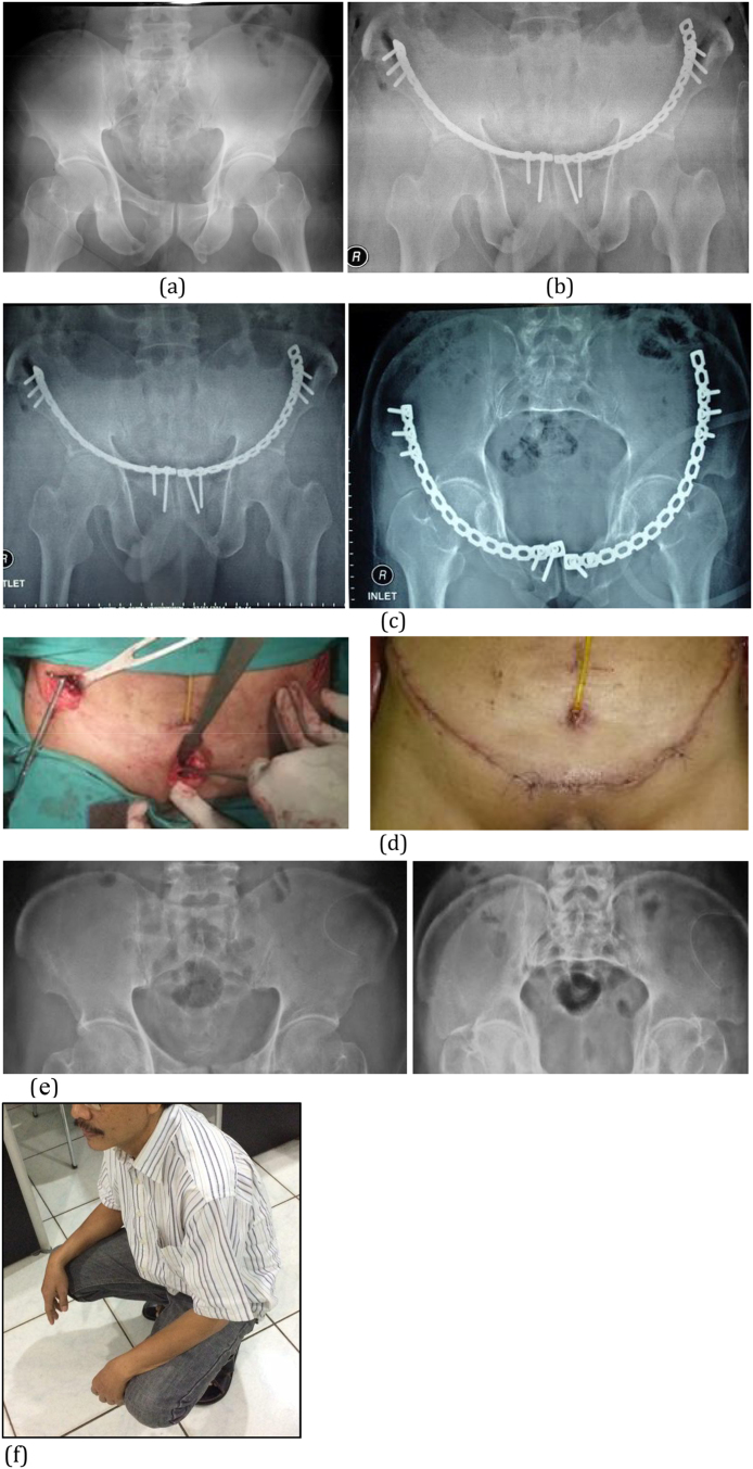 Fig. 4