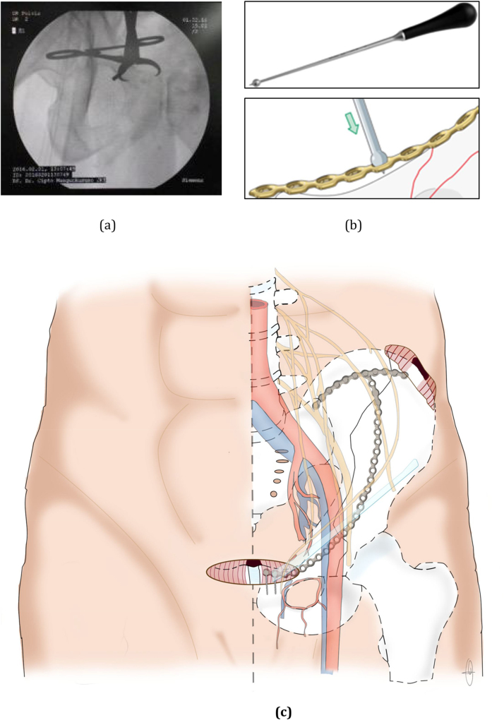 Fig. 2