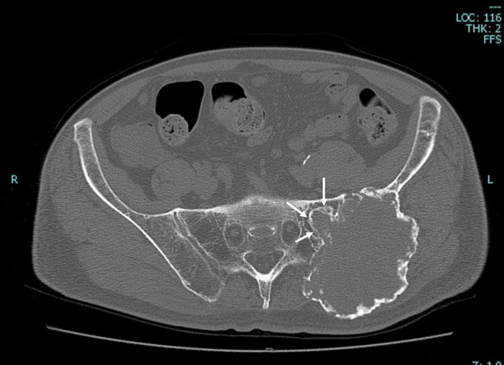 Fig. 6.