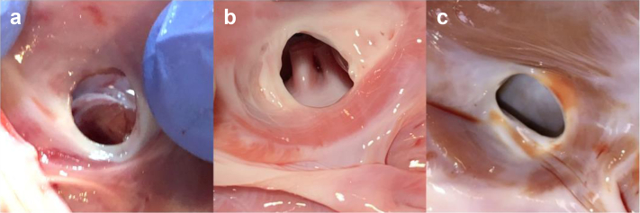 Figure 2