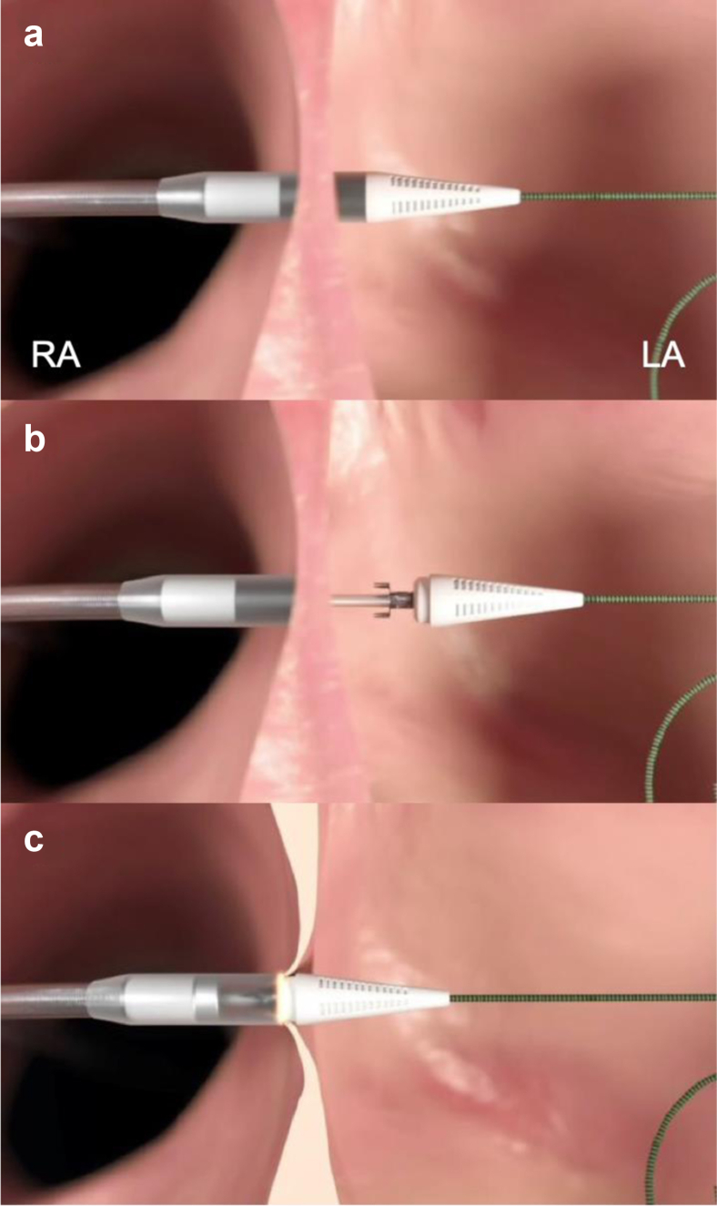 Figure 1