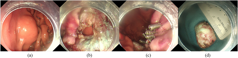 Fig. 2