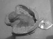 Fig. 11