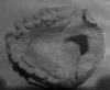 Fig. 12