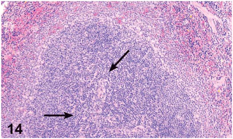 Figure 14