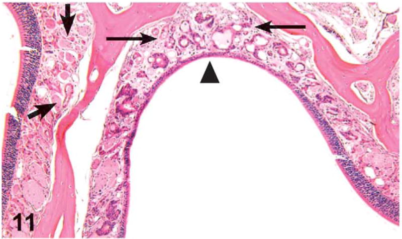 Figure 11