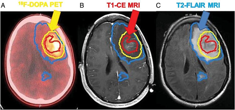 Fig. 2.