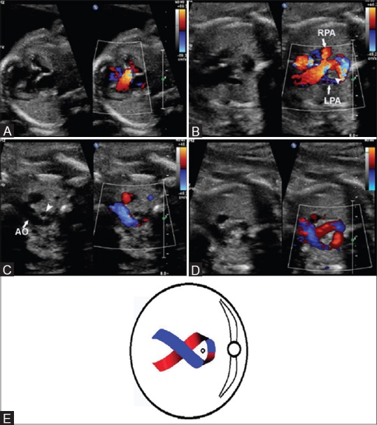 Figure 1 (A-E)