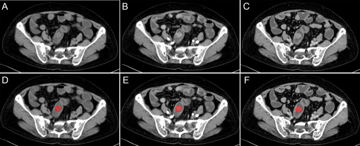 Figure 1