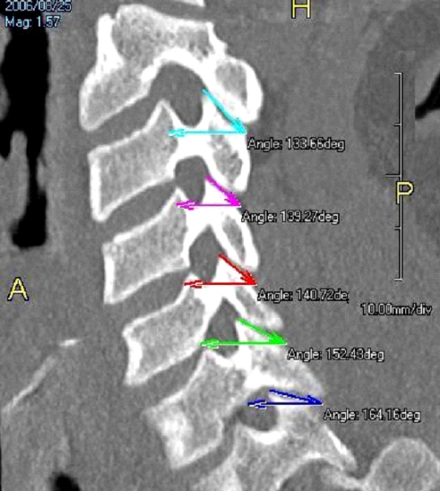 Fig. 3