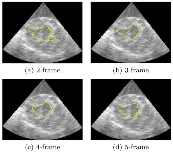 Figure 9