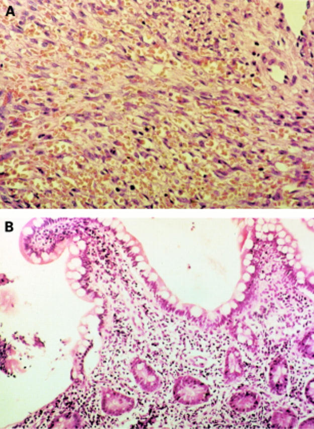 Figure 2  