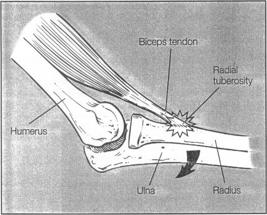 Fig 2.