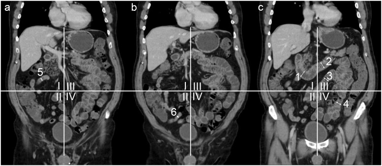 Fig 3