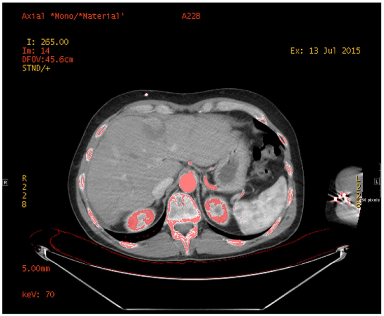 Fig. 2.