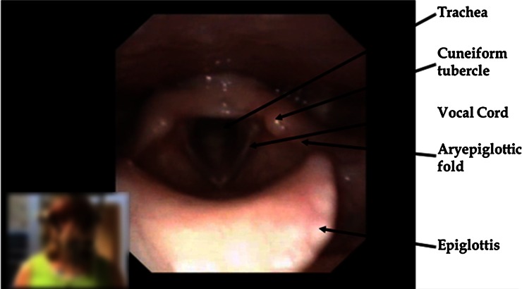 Fig. 1