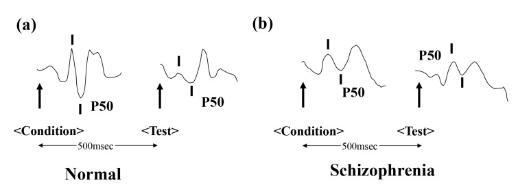 Fig. (1)