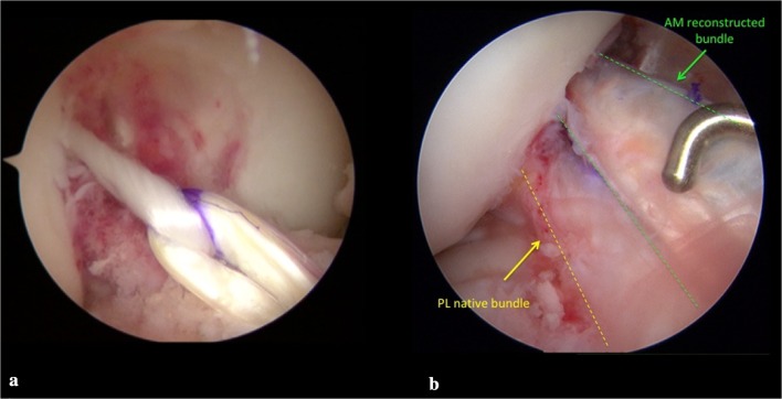 Fig. 2