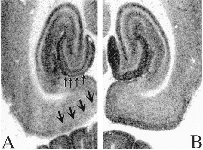 Fig. 11.