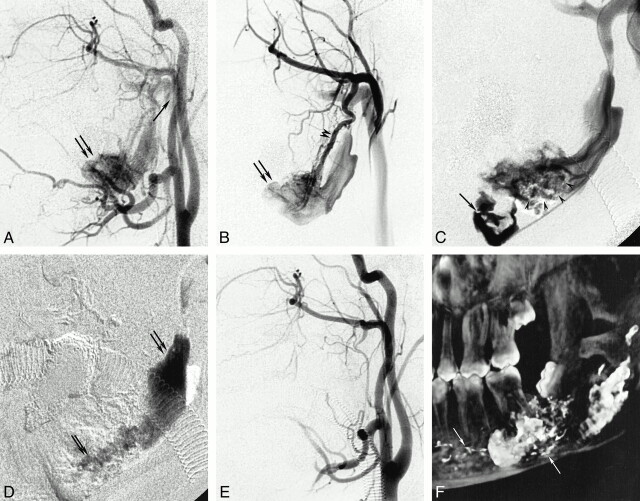 fig 1.