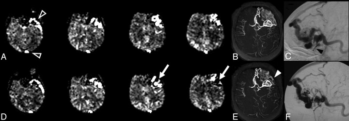 Fig 2.