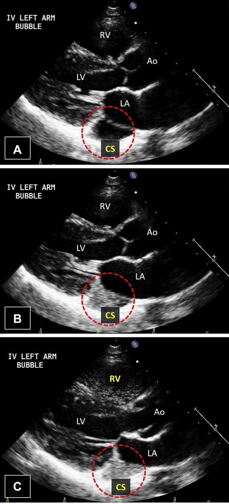 Figure 2